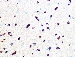 TPPP/p25 Rabbit anti-Mouse, Rat, Clone: 3S5U9, Novus Biologicals 100 &mu;g;