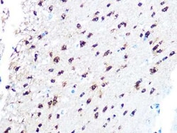 TPPP/p25 Rabbit anti-Mouse, Rat, Clone: 3S5U9, Novus Biologicals 100 &mu;g;