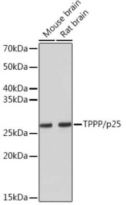 TPPP/p25 Rabbit anti-Mouse, Rat, Clone: 3S5U9, Novus Biologicals 100 &mu;g;