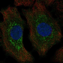 TPPP/p25 Antibody, Novus Biologicals:Antibodies:Primary Antibodies