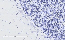 TPPP/p25 Antibody, Novus Biologicals 0.1mg; Unlabeled:Antibodies, Polyclonal