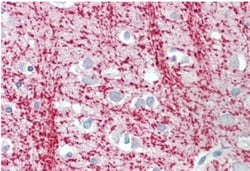 TPPP/p25 Antibody, Novus Biologicals 0.1mg; Unlabeled:Antibodies, Polyclonal