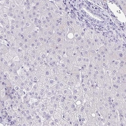 TPPP/p25 Antibody, Novus Biologicals 0.1mL; Unlabeled:Antibodies, Polyclonal