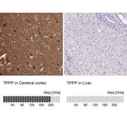 TPPP/p25 Antibody, Novus Biologicals 0.1mL; Unlabeled:Antibodies, Polyclonal