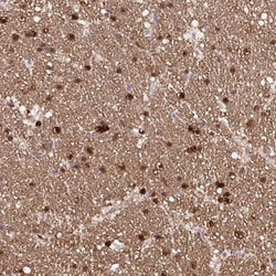 TPPP/p25 Antibody, Novus Biologicals:Antibodies:Primary Antibodies