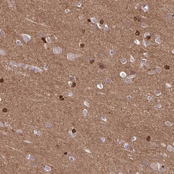 TPPP/p25 Antibody, Novus Biologicals:Antibodies:Primary Antibodies