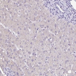 TPPP/p25 Antibody, Novus Biologicals:Antibodies:Primary Antibodies