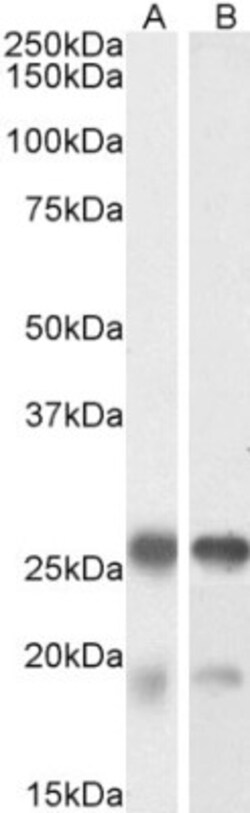 TPPP/p25 Antibody, Novus Biologicals 0.1mg; Unlabeled:Antibodies, Polyclonal