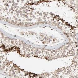 TPPP2 Antibody, Novus Biologicals 0.1mL; Unlabeled:Antibodies, Polyclonal