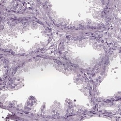 TPPP2 Antibody, Novus Biologicals 0.1mL; Unlabeled:Antibodies, Polyclonal