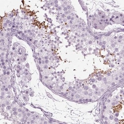 TPPP2 Antibody, Novus Biologicals 0.1mL; Unlabeled:Antibodies, Polyclonal