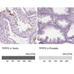 TPPP2 Antibody, Novus Biologicals 0.1mL; Unlabeled:Antibodies, Polyclonal