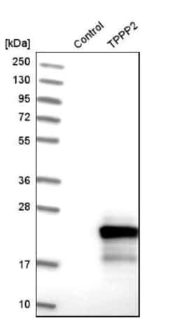 TPPP2 Antibody, Novus Biologicals 0.1mL; Unlabeled:Antibodies, Polyclonal