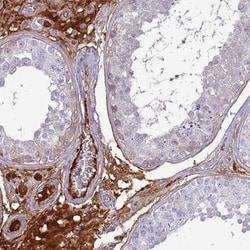 TPPP3 Antibody, Novus Biologicals:Antibodies:Primary Antibodies