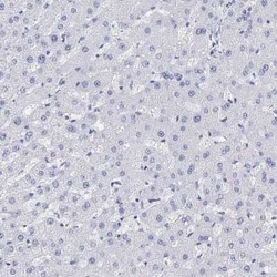 TPPP3 Rabbit anti-Human, Polyclonal, Novus Biologicals 100 &mu;g | Buy Online | Bio-Techne | Fisher Scientific