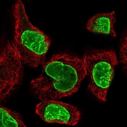 TPR Antibody, Novus Biologicals 0.1mL; Unlabeled:Antibodies, Polyclonal