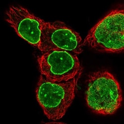 TPR Antibody, Novus Biologicals 0.1mL; Unlabeled:Antibodies, Polyclonal