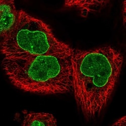TPR Antibody, Novus Biologicals:Antibodies:Primary Antibodies