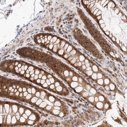 TPR Antibody, Novus Biologicals 0.1mL; Unlabeled:Antibodies, Polyclonal