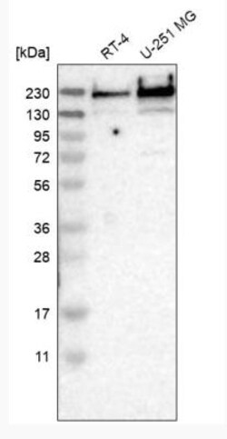 TPR Antibody, Novus Biologicals 0.1 mL | Buy Online | Novus Biologicals | Fisher Scientific