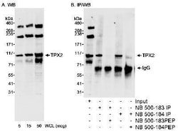 TPX2 Antibody, Novus Biologicals 0.1mg; Unlabeled:Antibodies, Polyclonal
