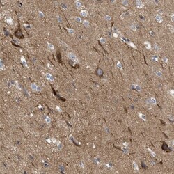 TR alpha/NR1A1/Thyroid Hormone Receptor alpha Antibody, Novus Biologicals