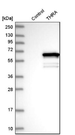 TR alpha/NR1A1/Thyroid Hormone Receptor alpha Antibody, Novus Biologicals