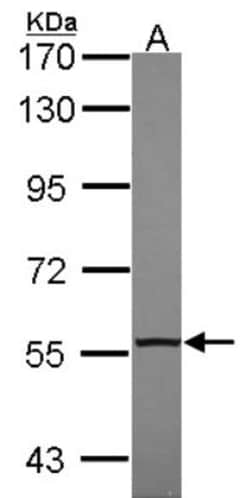 TR4/NR2C2 Antibody, Novus Biologicals 0.1mL; Unlabeled:Antibodies, Polyclonal