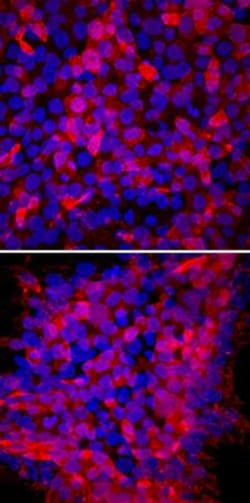 TRA-1-60(R) Antibody (TRA-1-60), Novus Biologicals 0.1mL; Unlabeled:Antibodies,