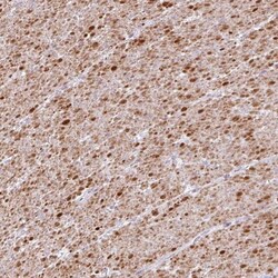 TRA2A Antibody, Novus Biologicals:Antibodies:Primary Antibodies