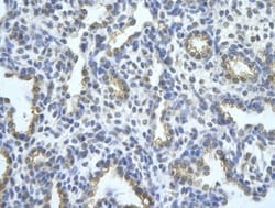 TRA2B Antibody, Novus Biologicals 100&mu;L; Unlabeled:Antibodies, Polyclonal