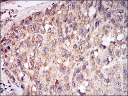 TRACP/PAP/ACP5 Antibody (7E6A11) - BSA Free, Novus Biologicals 0.1mL; Unlabeled:Antibodies,