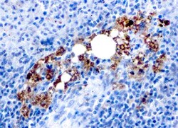 TRACP/PAP/ACP5 Antibody (ACP5/1070), Novus Biologicals 0.2mg; Unlabeled:Antibodies,