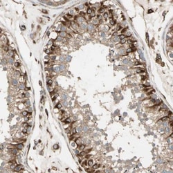 AK2 Antibody, Novus Biologicals:Antibodies:Primary Antibodies