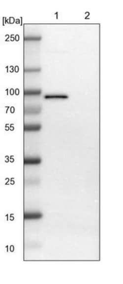 AK2 Antibody, Novus Biologicals:Antibodies:Primary Antibodies
