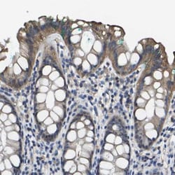 TRAF-6 Antibody, Novus Biologicals 0.1mL; Unlabeled:Antibodies, Polyclonal