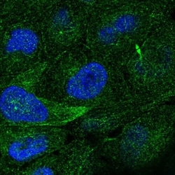 TRAIL/TNFSF10 Antibody, Novus Biologicals:Antibodies:Primary Antibodies