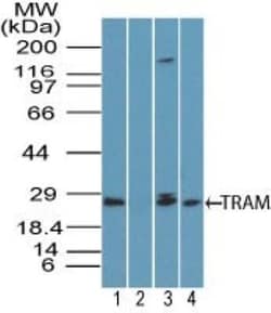 TRAM/TICAM2 Antibody, Novus Biologicals 0.1mg; Unlabeled:Antibodies, Polyclonal