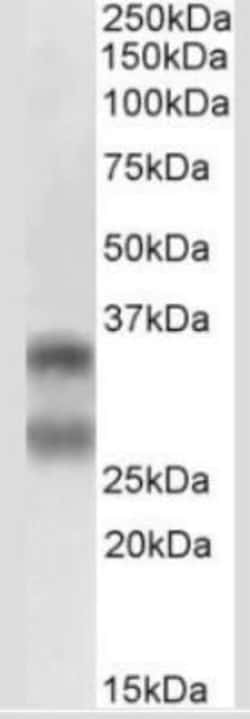TRANCE/TNFSF11/RANK L Antibody (12A668) - BSA Free, Novus Biologicals:Antibodies:Primary