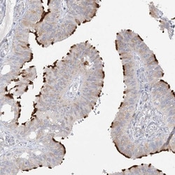 TRANK1 Antibody, Novus Biologicals 0.1mL; Unlabeled:Antibodies, Polyclonal