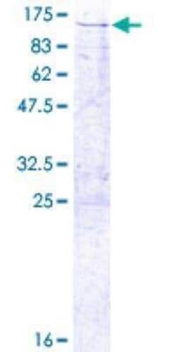 Novus Biologicals Recombinant Human TRAP1 GST (N-Term) Protein 25 &mu;g | Buy Online | Novus Biologicals&trade; | Fisher Scientific