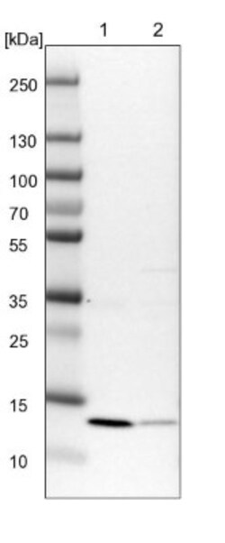 TRAPPC2L Antibody, Novus Biologicals 0.1mL; Unlabeled:Antibodies, Polyclonal