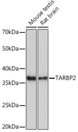 TRBP Rabbit anti-Human, Mouse, Rat, Clone: 9E6C9, Novus Biologicals 20 &mu;g | Buy Online | Novus Biologicals | Fisher Scientific