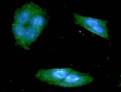 TREM2 Antibody (2B5) - BSA Free, Novus Biologicals:Antibodies:Primary Antibodies
