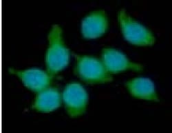 TREM2 Antibody (2B5) - BSA Free, Novus Biologicals 0.1mL; Unlabeled:Antibodies,