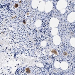 TREML1/TLT-1 Antibody, Novus Biologicals 0.1mL; Unlabeled:Antibodies, Polyclonal