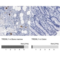 TREML1/TLT-1 Antibody, Novus Biologicals 0.1mL; Unlabeled:Antibodies, Polyclonal