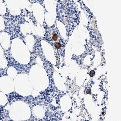 TREML1/TLT-1 Antibody, Novus Biologicals:Antibodies:Primary Antibodies