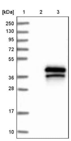 TREML1/TLT-1 Antibody, Novus Biologicals 0.1mL; Unlabeled:Antibodies, Polyclonal