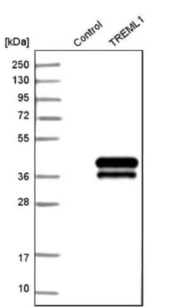 TREML1/TLT-1 Antibody, Novus Biologicals:Antibodies:Primary Antibodies